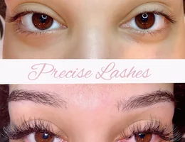 Precise Laser Hair Removal & Esthetics