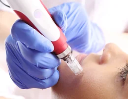 Manhattan Microneedling