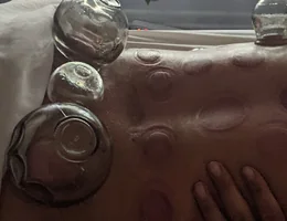 CuppingNYC