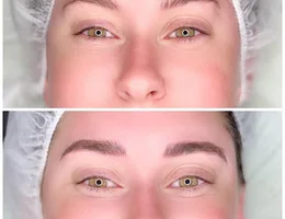 Beauty Lab Microblading Charlotte | Plasma Fibroblast