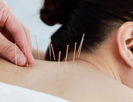 Chinatown Acupuncture