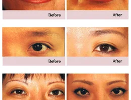 Forever Permanent Makeup | 포에버 반영구화장 자연눈썹