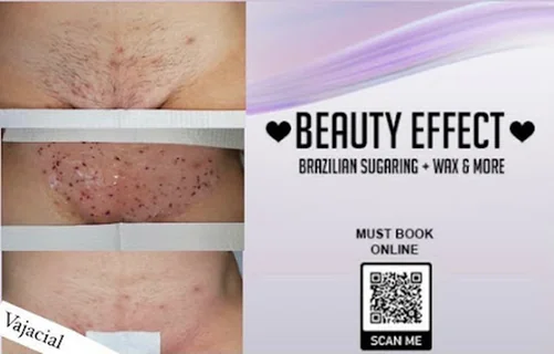 Photo Beauty Effect Brazilian Sugaring Hair Removal Waxing