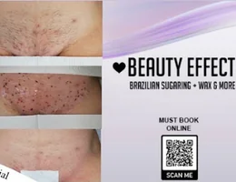 Beauty Effect Brazilian Sugaring Hair Removal Waxing