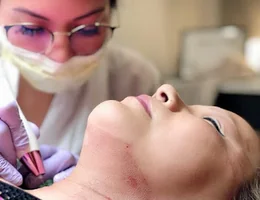 Beauty Lab Microblading Charlotte | Plasma Fibroblast