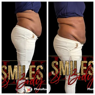 Photo JAK Smiles- Body-Esthetics