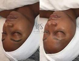 Bare Skin Facial and Waxing Studio