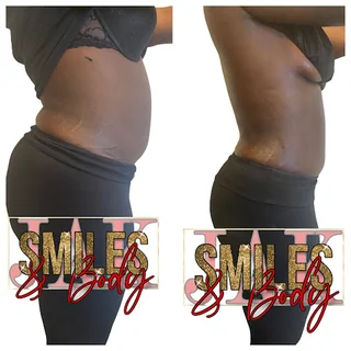 Photo JAK Smiles- Body-Esthetics