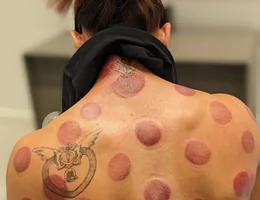 CuppingNYC