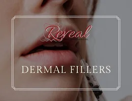 Reveal Medical Aesthetics