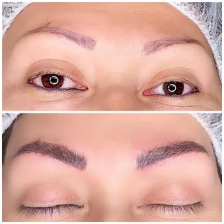 Photo Beauty Lab Microblading Charlotte | Plasma Fibroblast