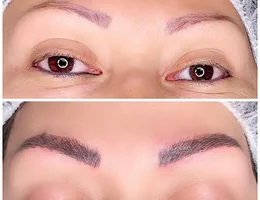 Beauty Lab Microblading Charlotte | Plasma Fibroblast