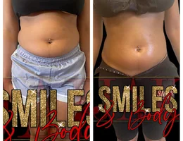 JAK Smiles- Body-Esthetics